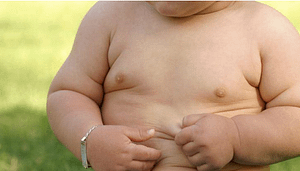 Childhood Obesity